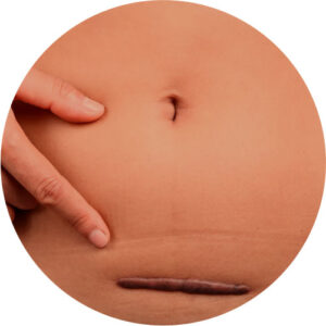 Cicatrizes 2 cicatrizes 02