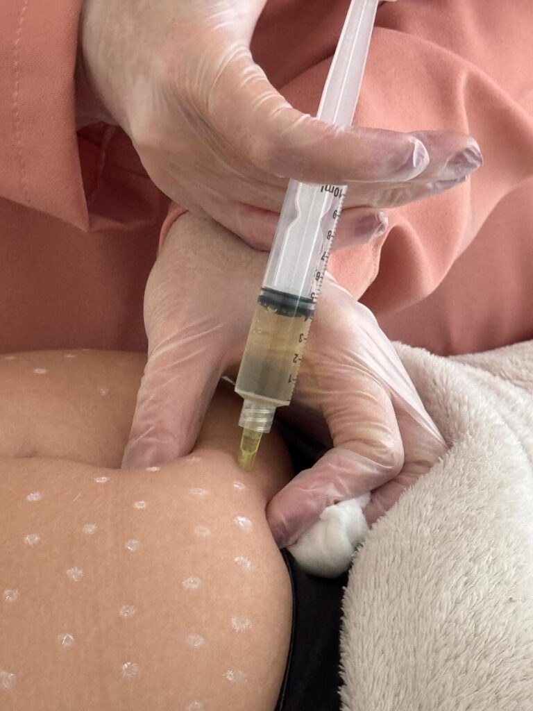 intradermoterapiaenzimaImagem do WhatsApp de 2025-08-26 à(s) 16.27.54_60a2b370