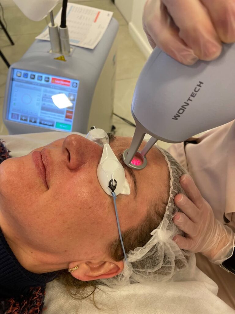 laser fracionadoImagem do WhatsApp de 2025-08-26 à(s) 19.36.07_7b205334