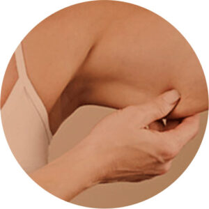 Flacidez 4 flacidez 04